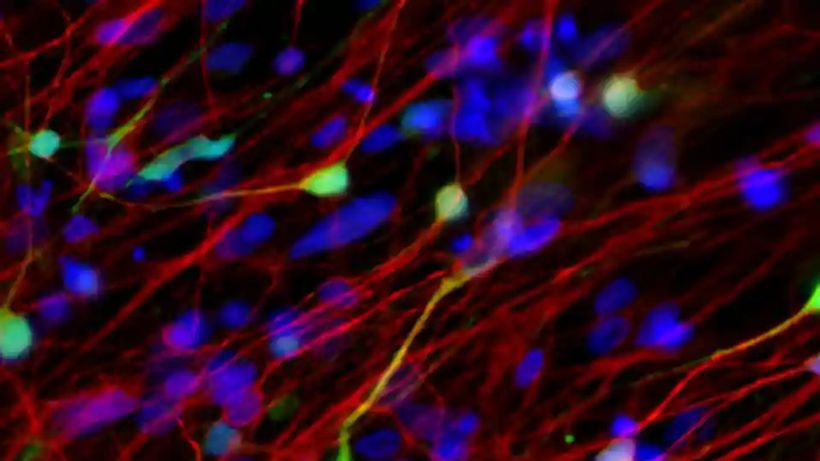 Automatic Pill Dispensers  Pill Reminders Walmart Com