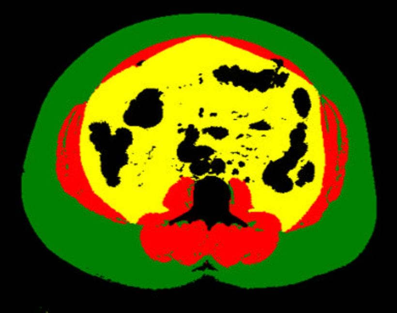 post featured image