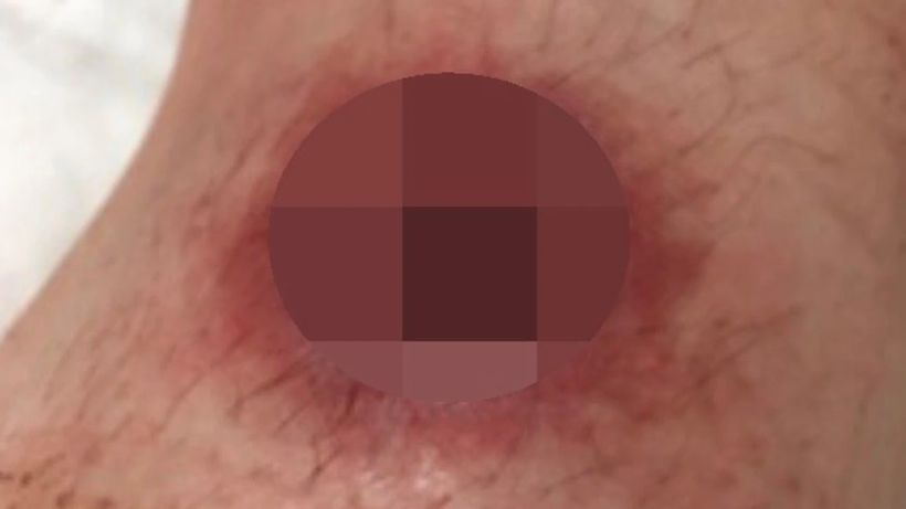 Article feature image