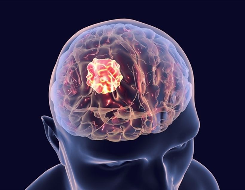 Article feature image