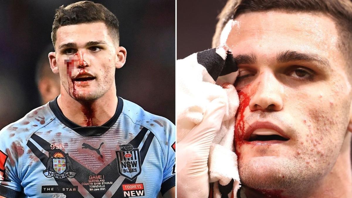 State of Origin: Nathan Cleary spurts blood as NSW Blues halfback avoids medical attention ...