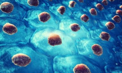 Article feature image