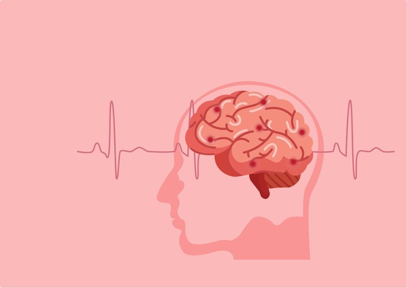 Article feature image