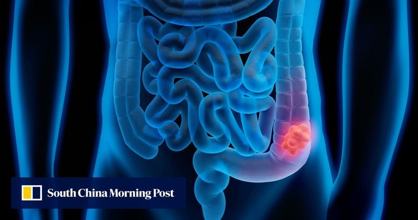 Article feature image