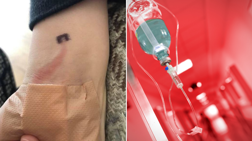 Mum S Warning After Scrape On Son S Arm Turns Into Potentially Deadly Sepsis 7news Com Au Rockhampton Online News