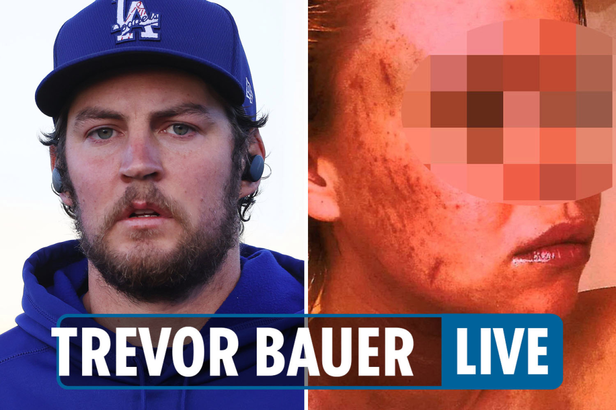 Trevor Bauer ‘assault Victim Pictures — Dodgers Stars Leave Extended After ‘accuser Texts 7304